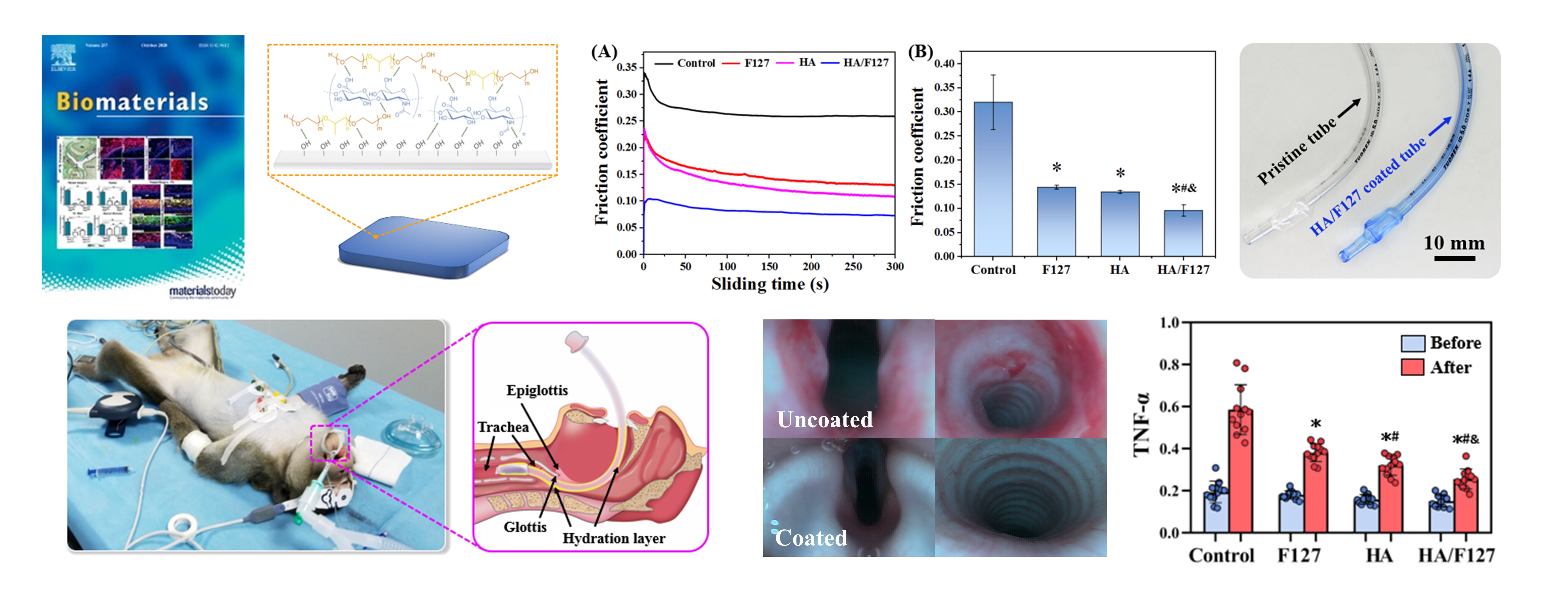 Highly improved aqueous lubrication of polymer surface by noncovalently bonding hyaluronic acid-based hydration layer for endotracheal intubation.